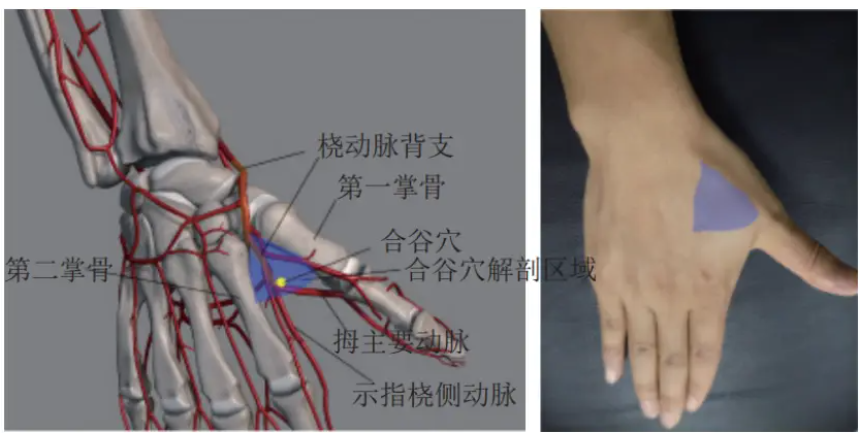 远端桡动脉压迫止血技术详细阐述